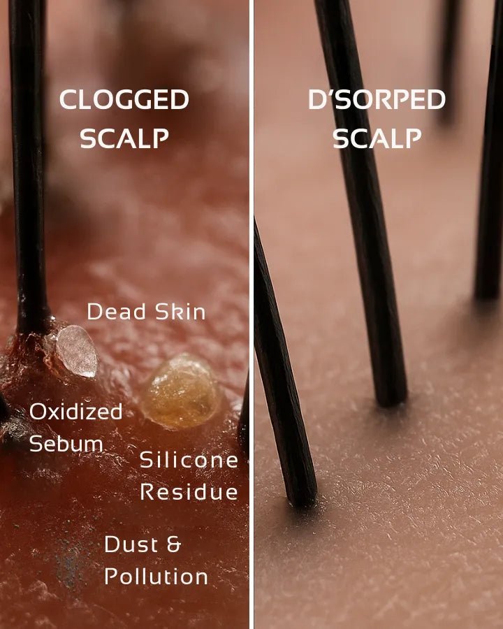 SCALP D&
