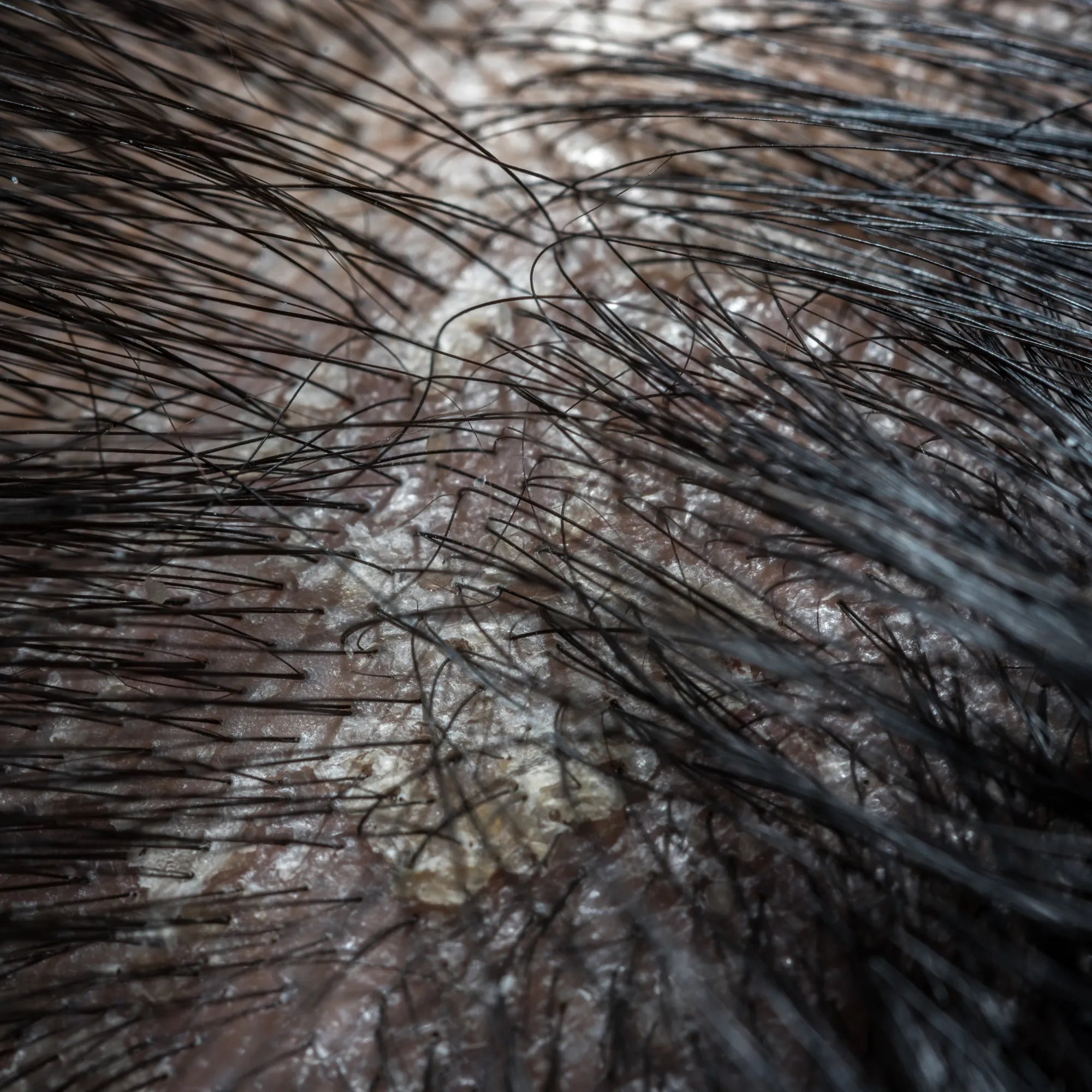 Is Silicone Buildup Ruining Your Hair? The Science of Scalp Health and Biomimetic Care