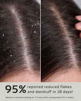 CUERI SCALP D&