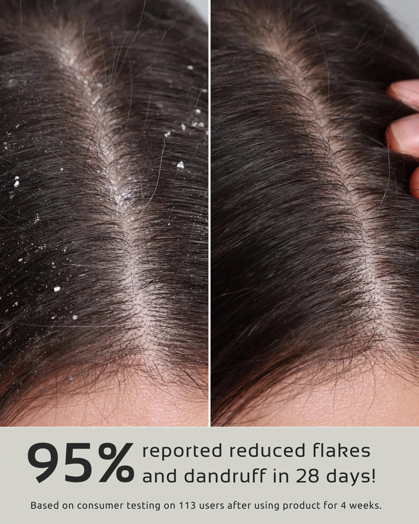 CUERI SCALP D&